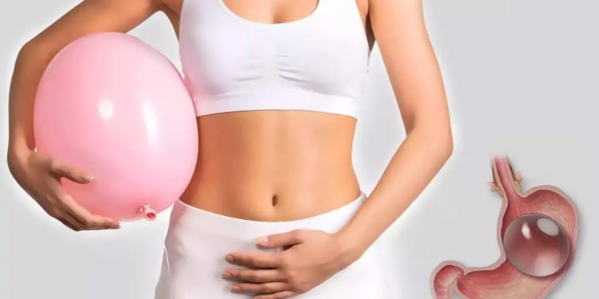 What’s Included in Allurion Balloon Cost?
