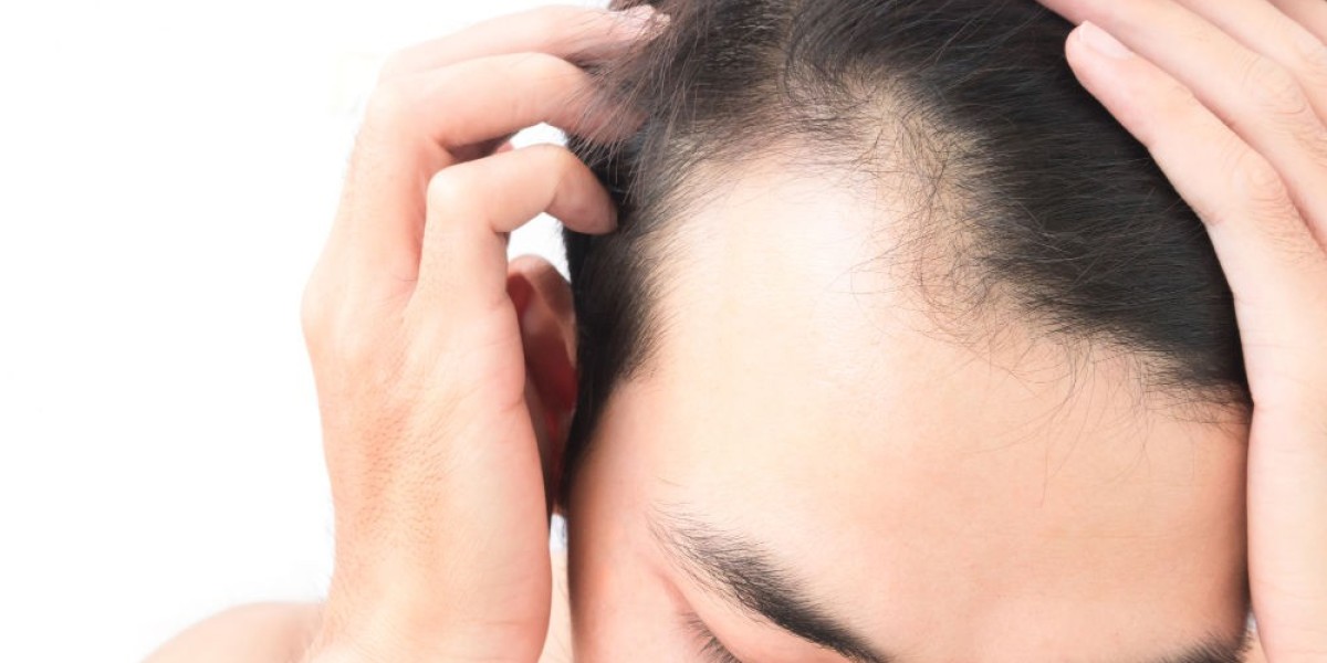 How Popular Is Front Line Hair Fixing in Dubai?