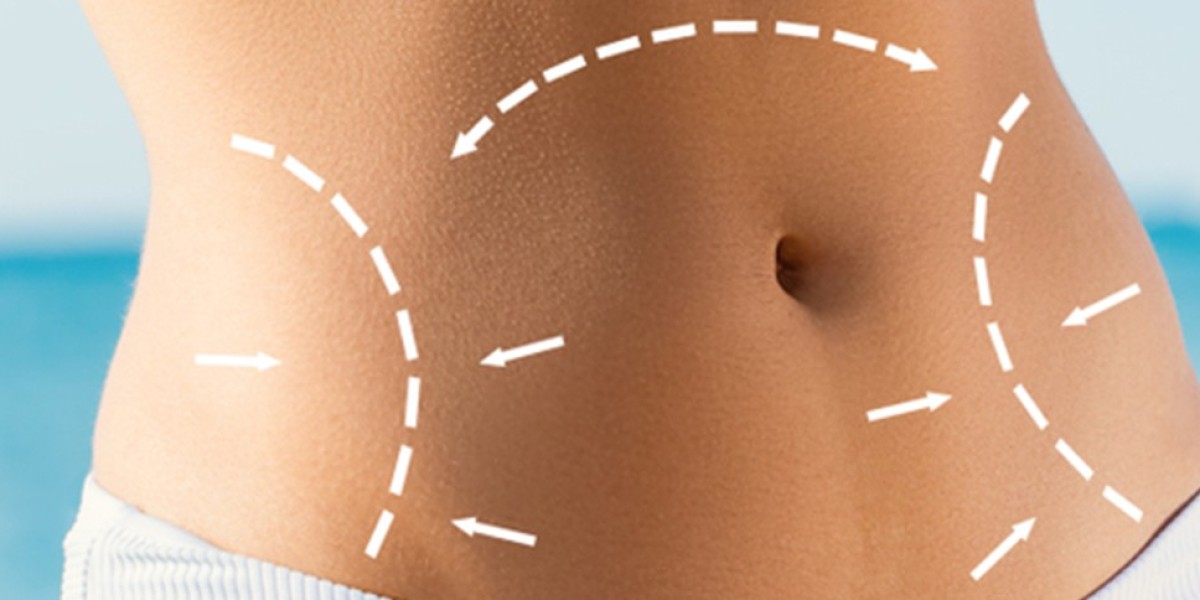 How much weight can you lose with a tummy tuck?