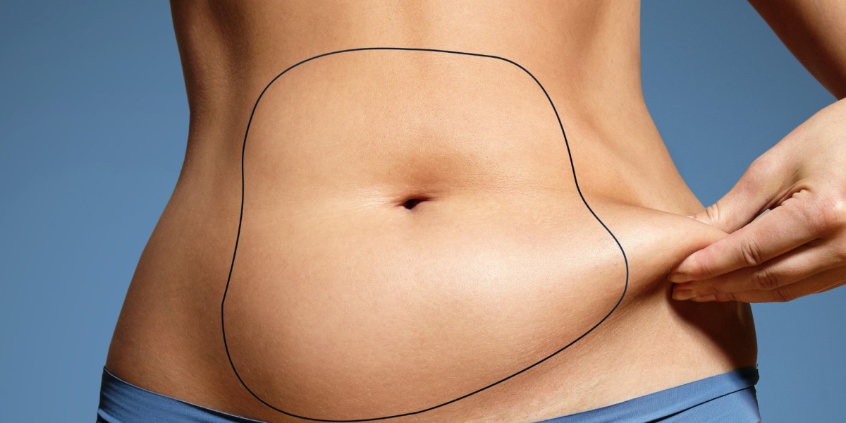 Can Tummy Tuck Remove Lower Belly Fat Effectively?