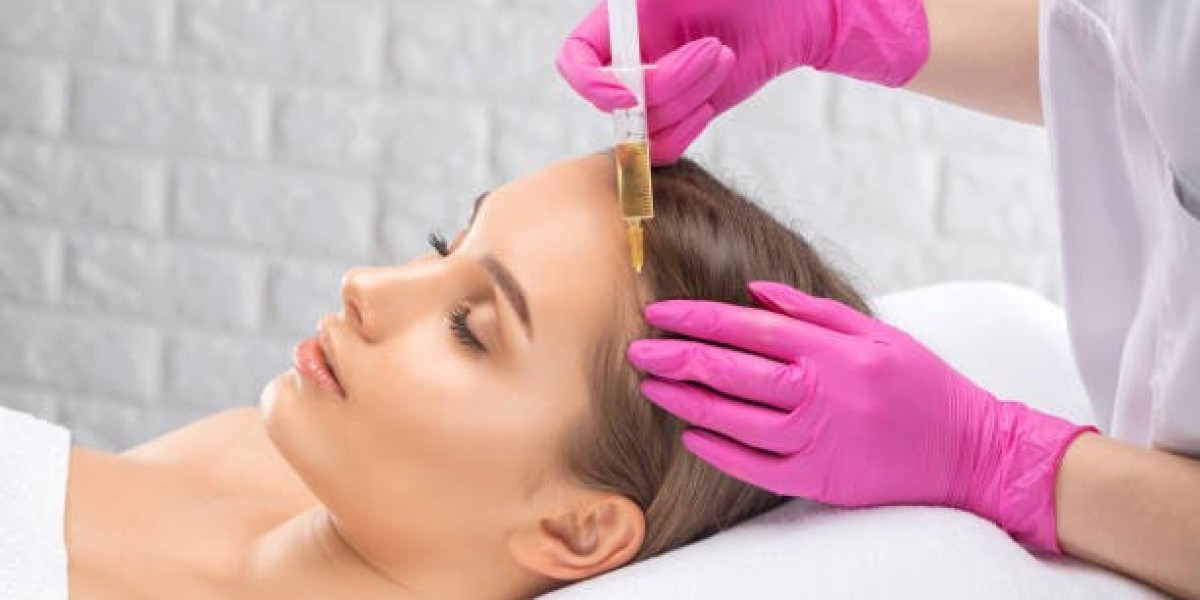 PRP Hair Treatment in Dubai: For Early Stage Balding