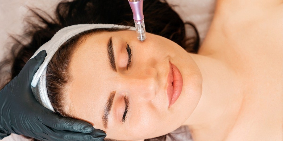 Affordable Microneedling Treatment for Face at Glamorous Clinic in Dubai