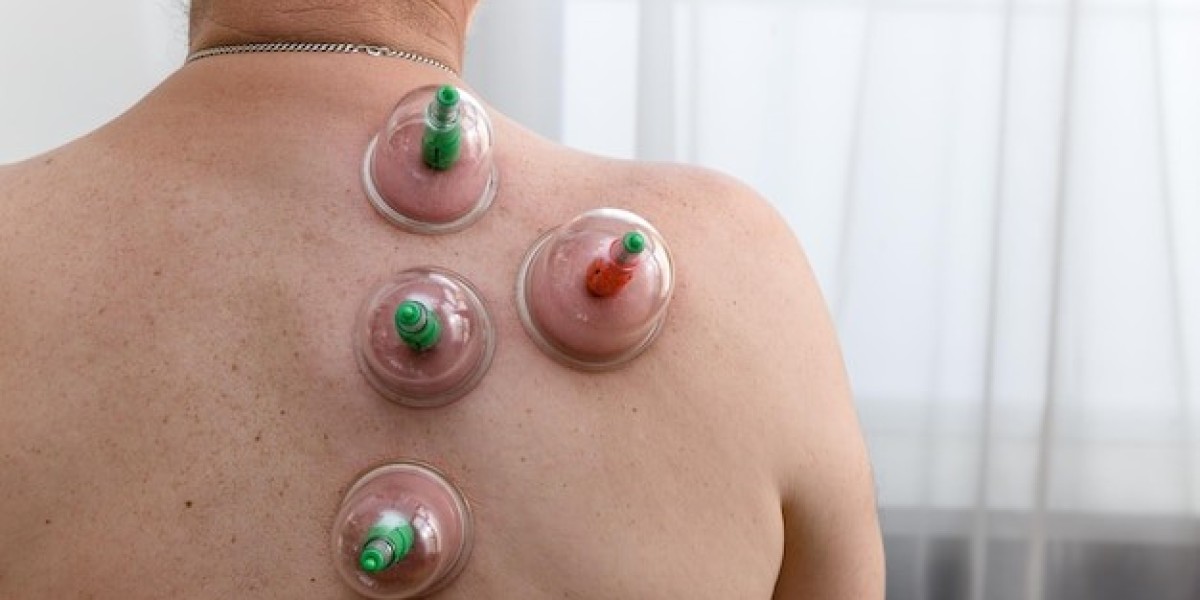 How Hijama Treatment Boosts Overall Health