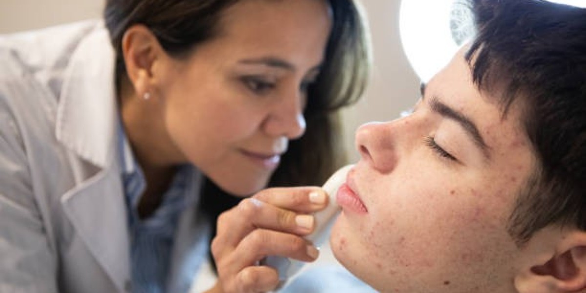 Pimples Treatment in Dubai: Restore Your Clear Skin