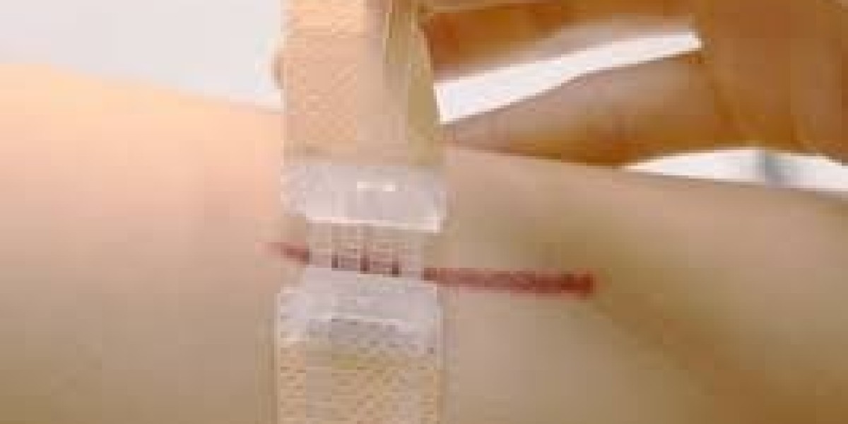Non-invasive Surgical Wound Closure Market Industry Share Growth Forecast And Trends