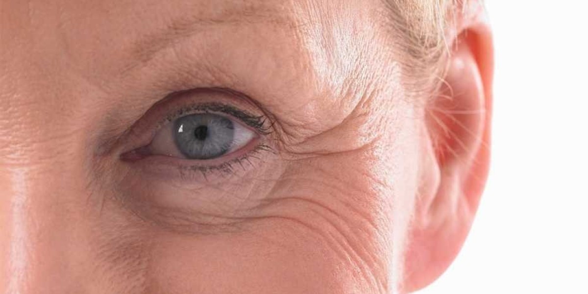 Non-Surgical Alternatives to Eyelid Surgery: Do They Work?