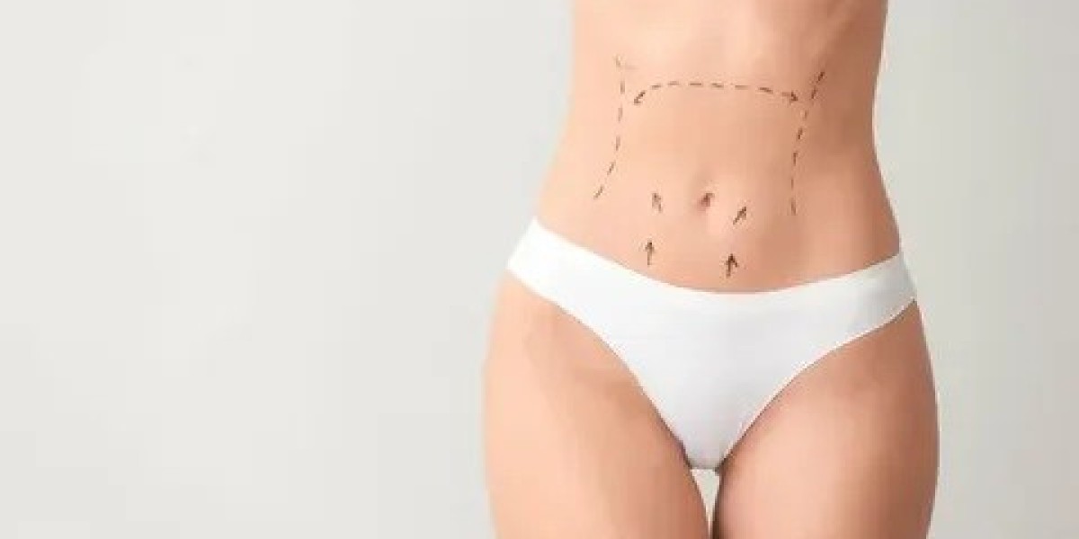 Circumferential Abdominoplasty in Islamabad: Is It Safe?