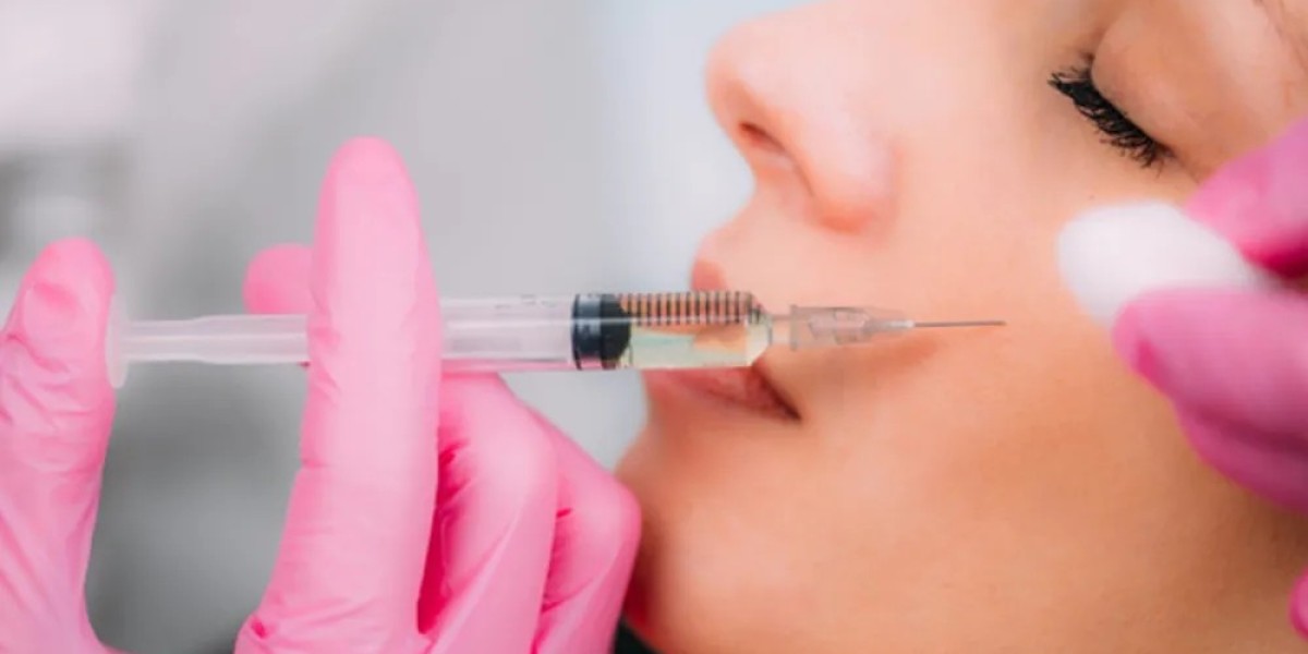Rediscover Radiant Facial Proportion with Cheek Fillers Injections