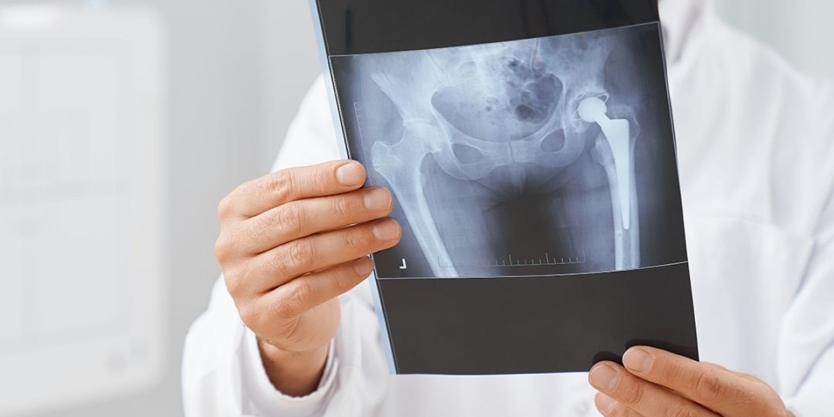 Your Guide to Alberta Hip and Knee Clinic Calgary