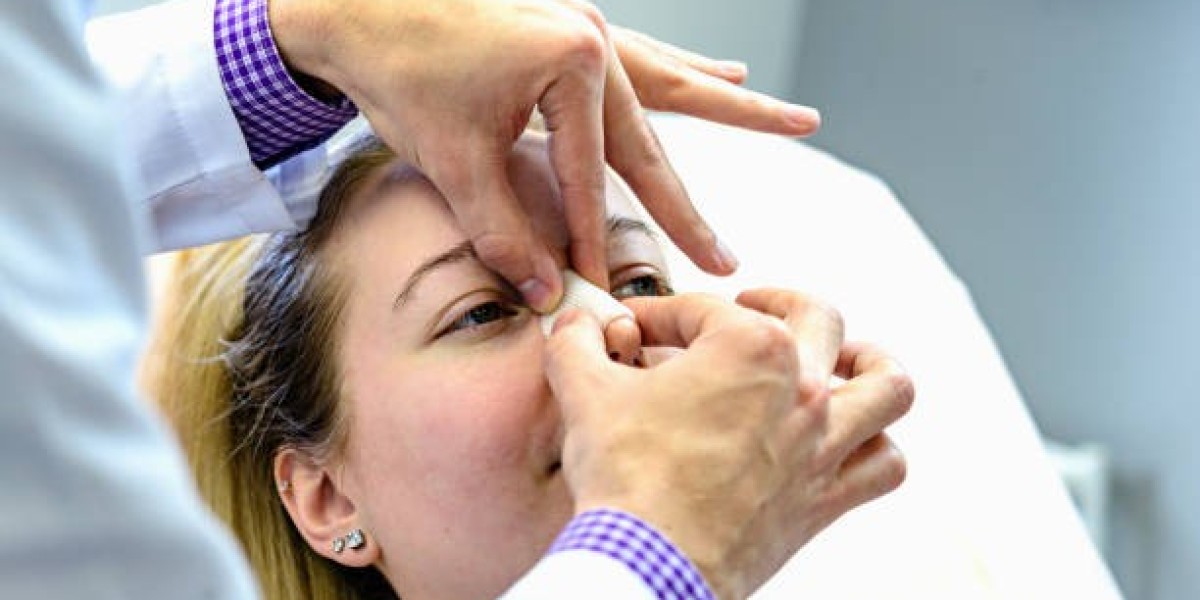 Riyadh Rhinoplasty Success Stories