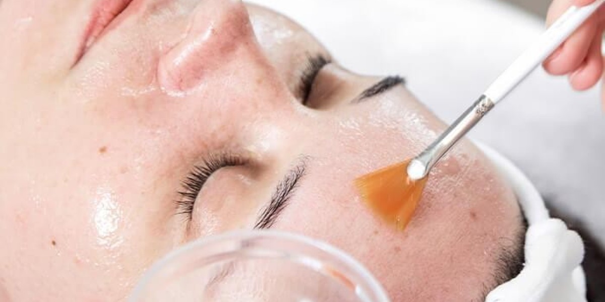 Are Glycolic Acid Peels Safe for Sensitive Skin?