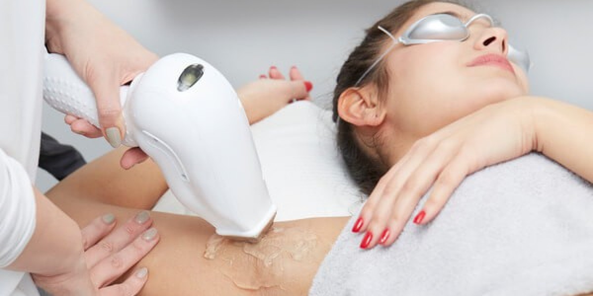 How Laser Hair Removal Supports Long-Term Hair Reduction