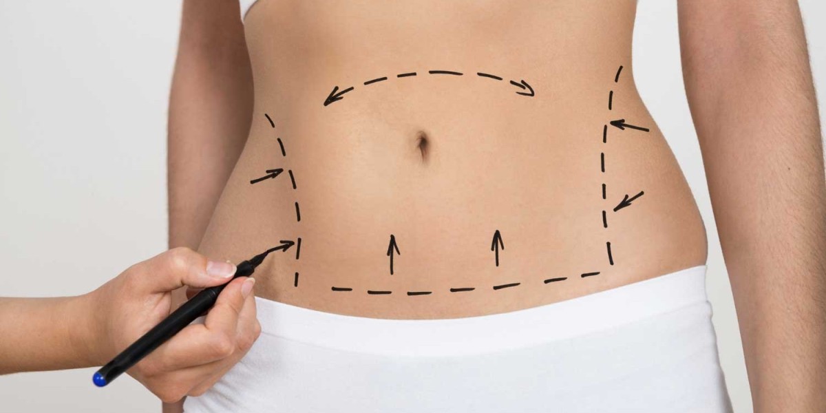 Is Tummy Tuck Surgery Safe for Older Adults?