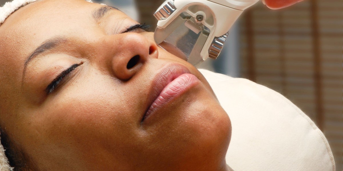 Can Laser Scar Removal Work on Dark Skin?