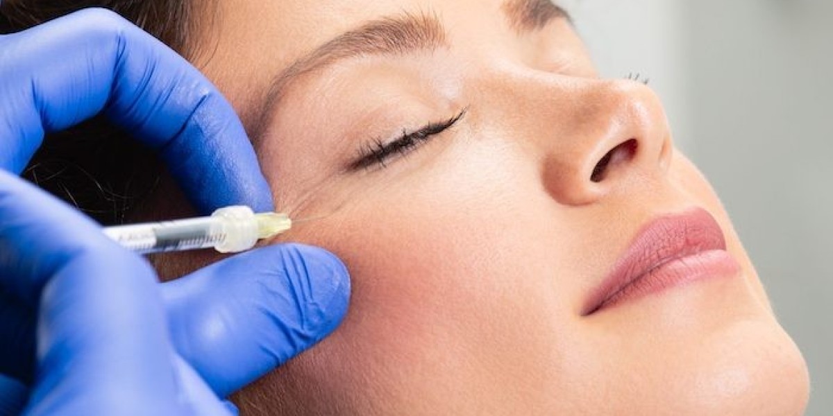 How Many Units of Botox Are Required for Effective Results?