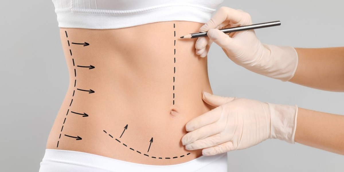 Affordable Tummy Tuck Options in Islamabad