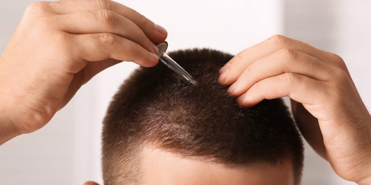 How Your Dosage Affects Finasteride 1mg