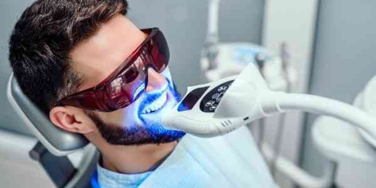 Professional vs. DIY Teeth Whitening in Bracknell