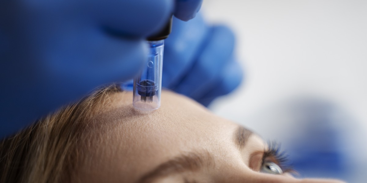 SkinPen Microneedling in Birmingham: Why Areje Aesthetics Is a Top Choice for Renewed, Glowing Skin