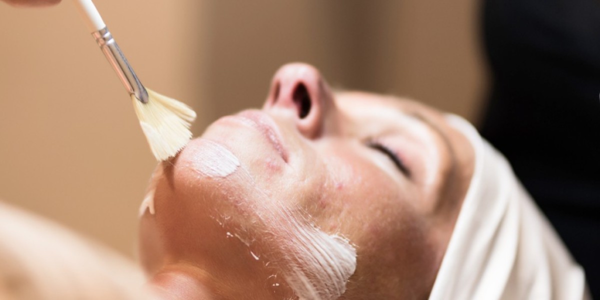Which Skin Concerns Can Be Improved Through Chemical Peels?