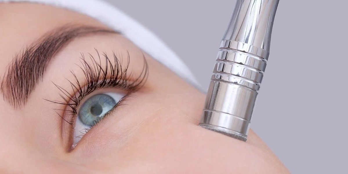 Are Diamond Peels Safe for People with Sensitive Skin?