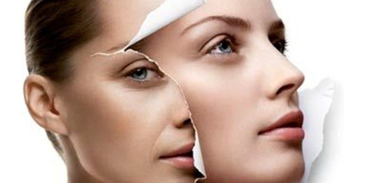 Skin Whitening in Dubai: Safe Procedures for All Skin Types