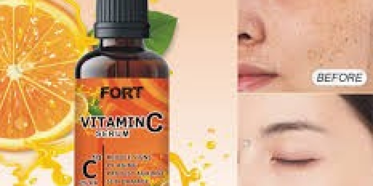 Vitamin C Serum for Melasma and Pigmentation Treatment