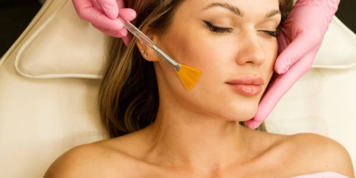 Chemical Peels in Dubai for Youthful, Glowing Skin