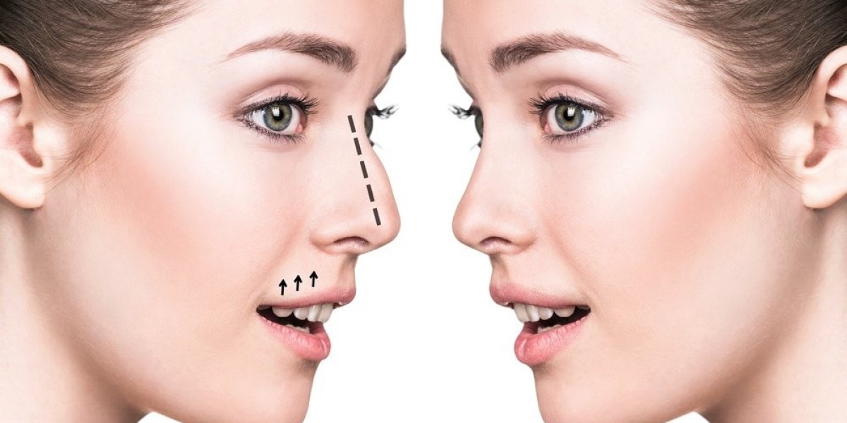 Can Non-Surgical Nose Job fix tip misalignment subtly?