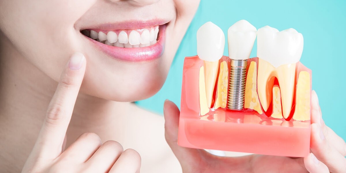 Can Dental Implants Bring Back Functional and Aesthetic Smiles?