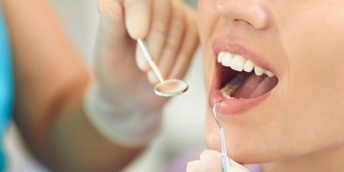 Tooth Filling Cost & Long-Term Value