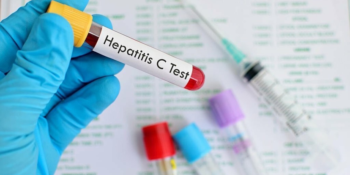 Symptoms That Mean You Should Take a Hepatitis C Test