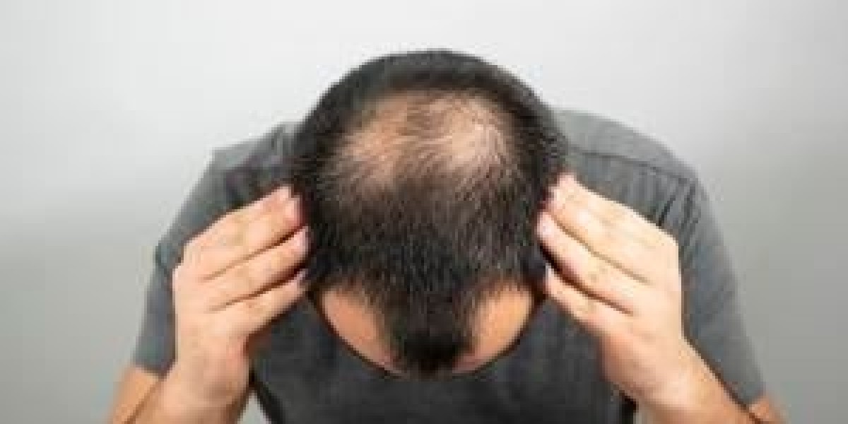 PRP Hair Treatment Deals Riyadh