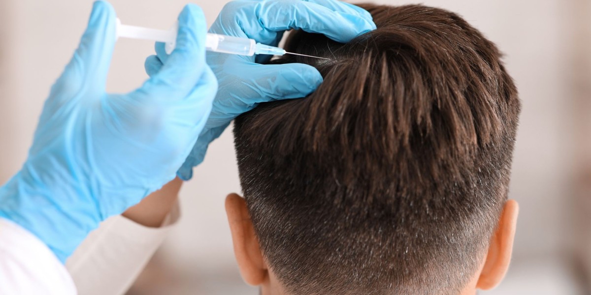 The Science Behind Hair Loss Treatments in Dubai – How They Really Work