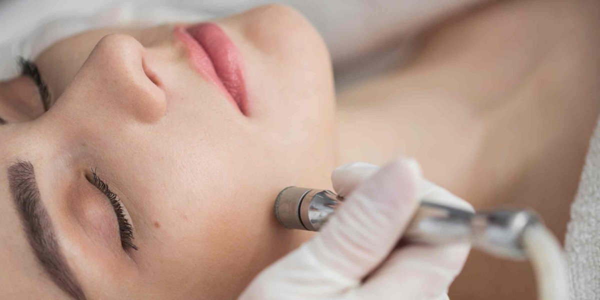How Well Do Diamond Peels Treat Hyperpigmentation Problems?