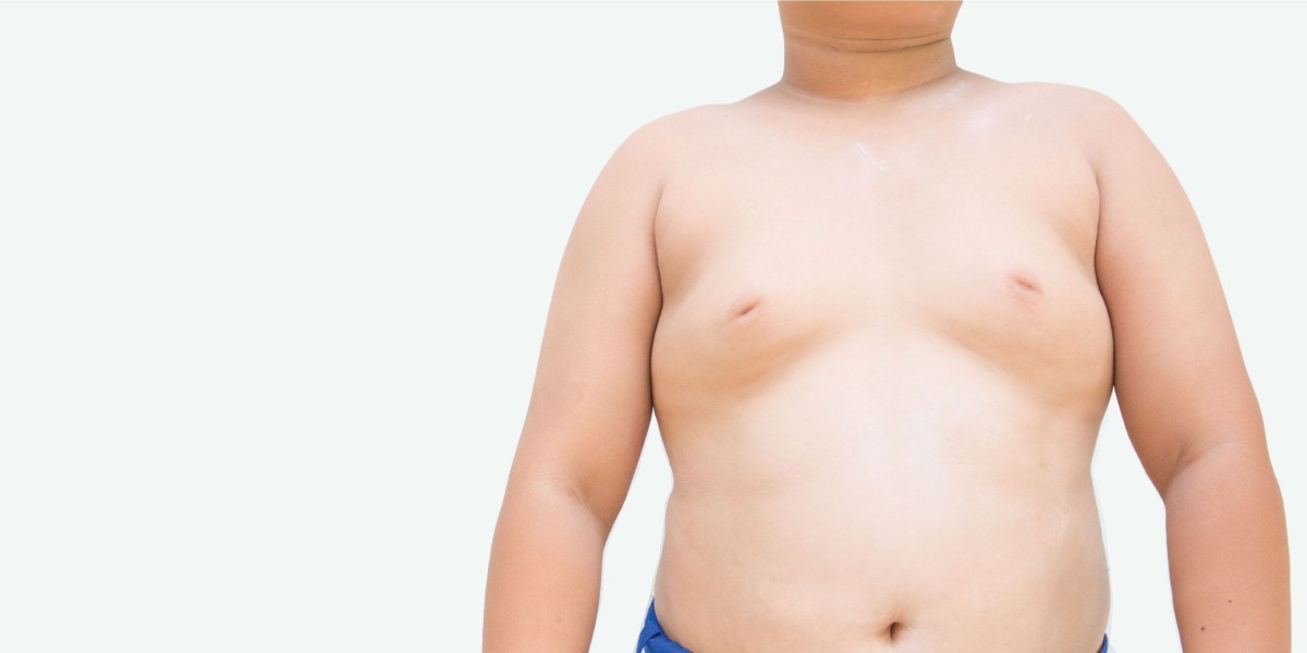 Does Gynecomastia in Dubai Enhance Chest Shape?