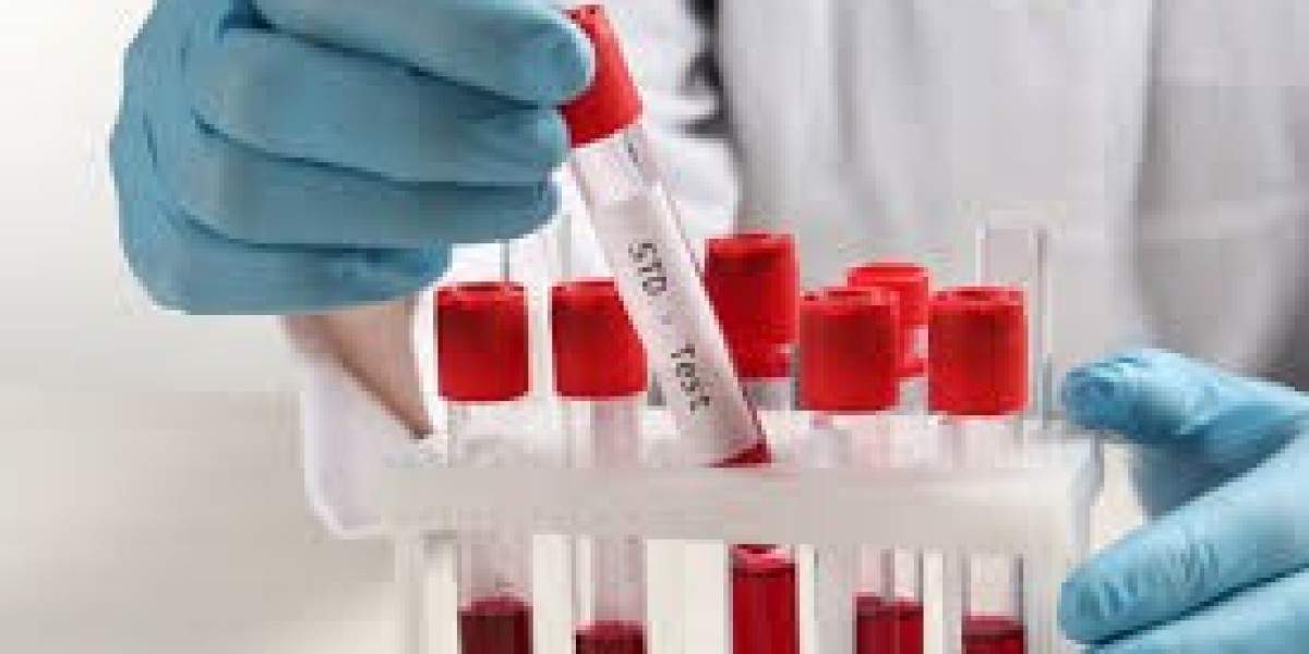 Home STD Test in Dubai: Discreet Solutions for Modern Lifestyles