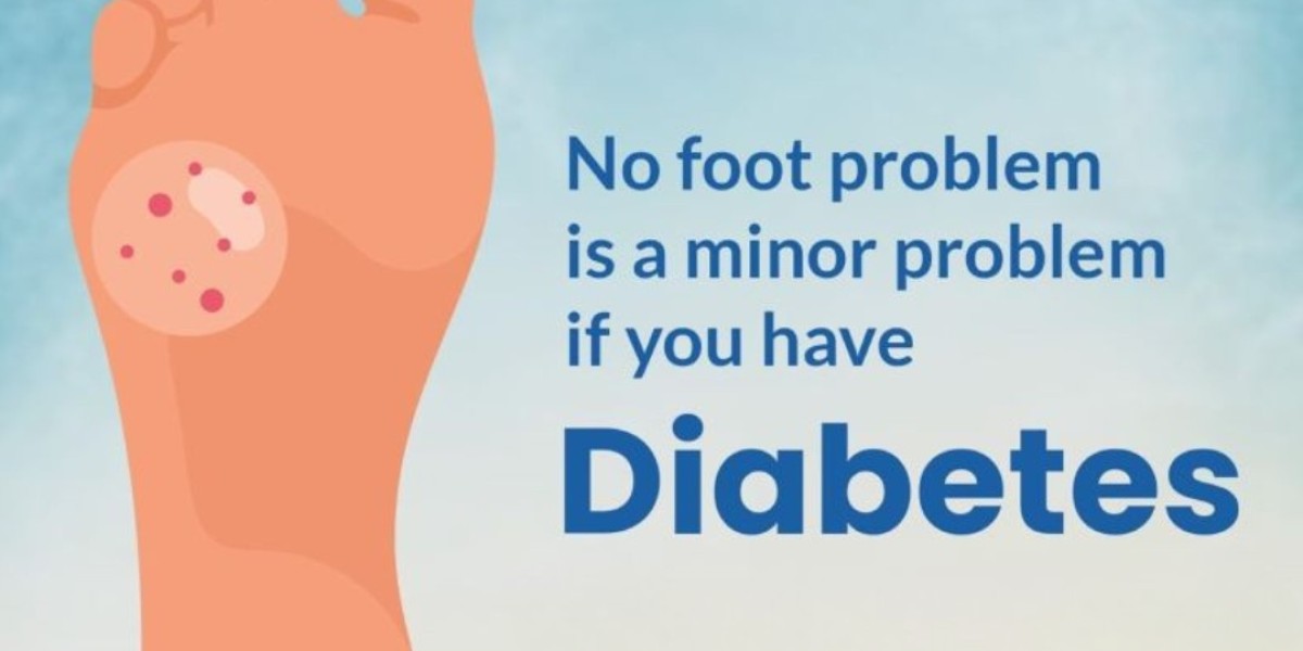 Comprehensive Guide to Preventing Diabetic Foot Complications