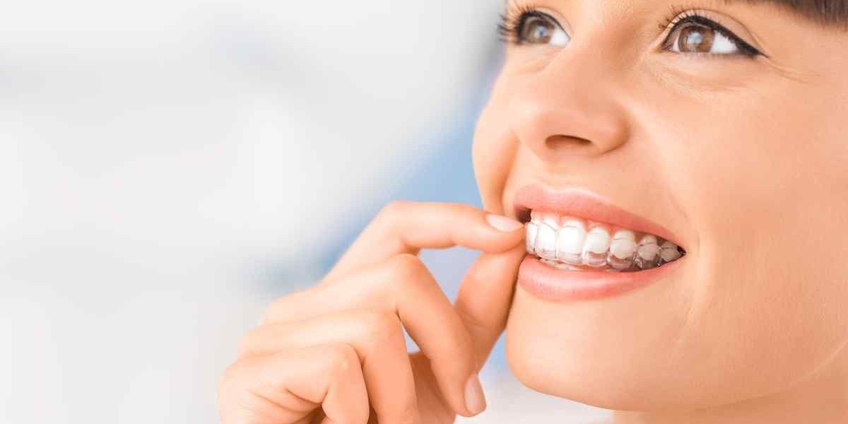 Aligners for Adults: Why It’s Never Too Late for Straight Teeth