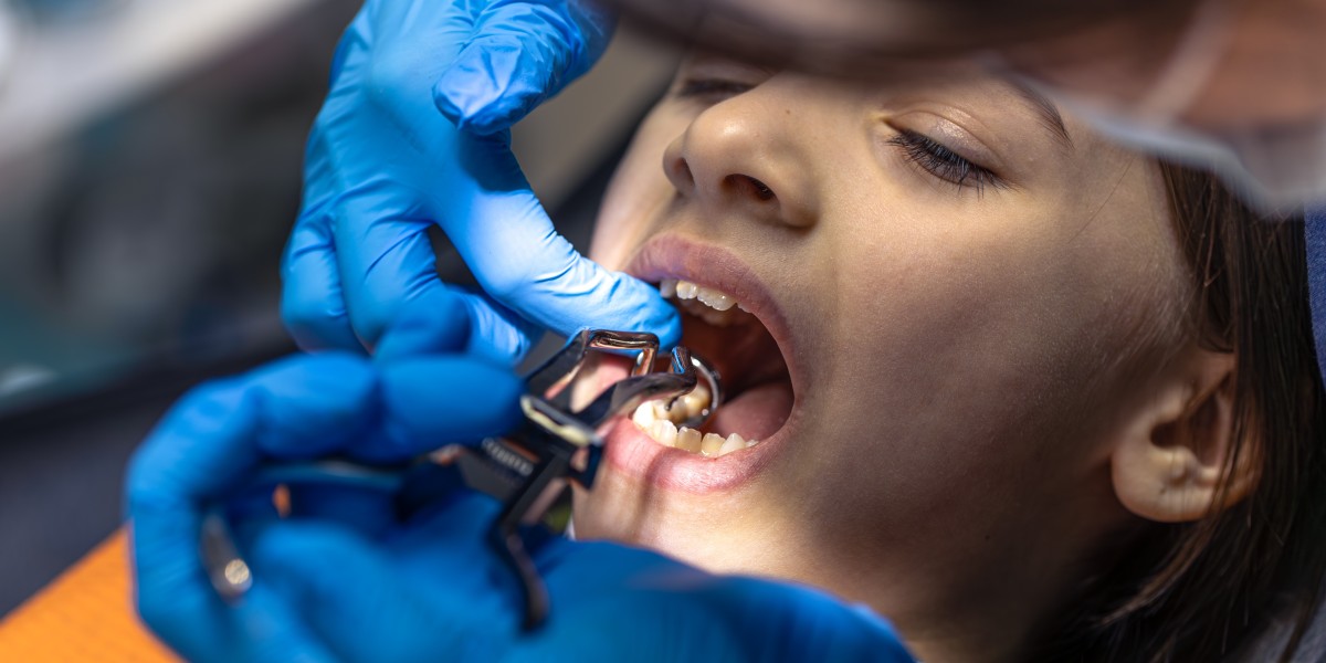 How Dental Implants Restore Damaged and Broken Teeth