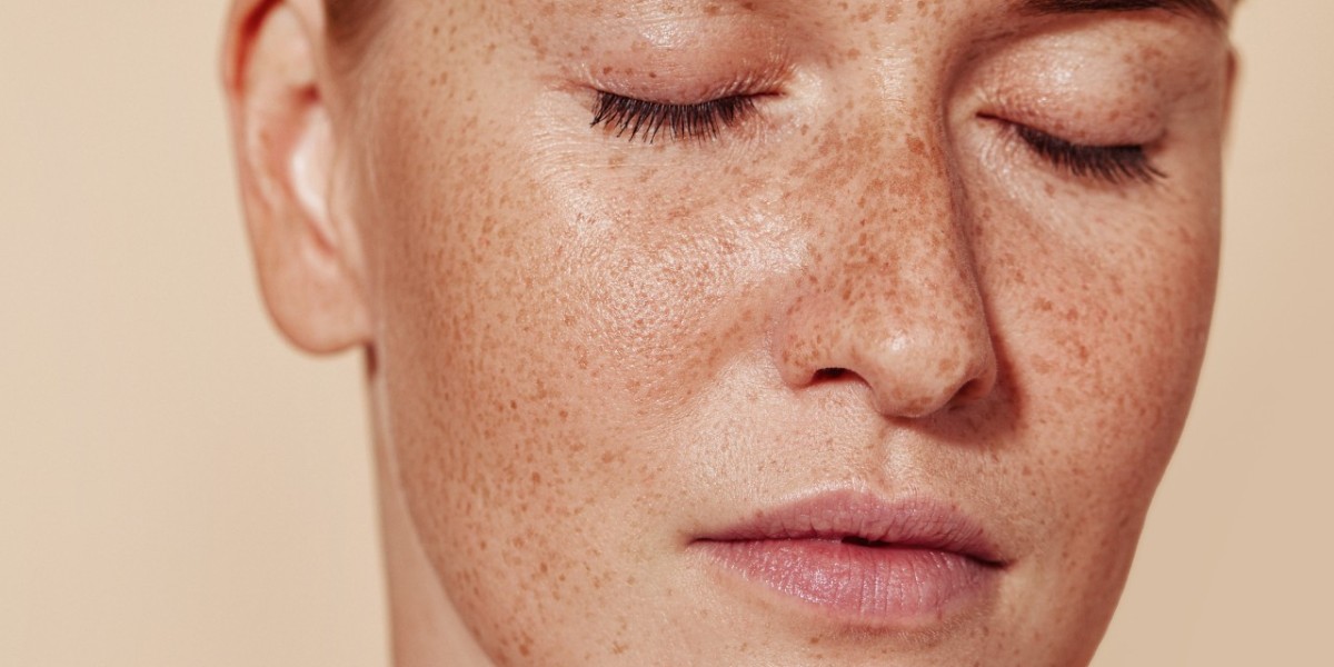 Safe and Effective Skin Pigmentation Treatment Techniques in Riyadh
