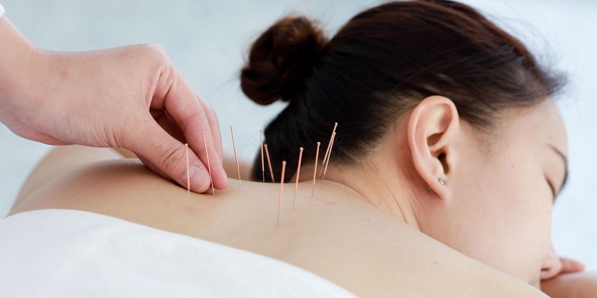 Can a Sugar Thread Lift refresh facial shape?