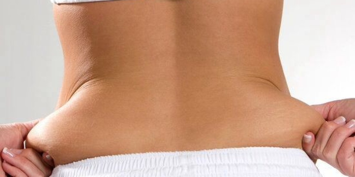 Tummy Tuck in Dubai for Men: Rising Male Interest Based on SEO Data
