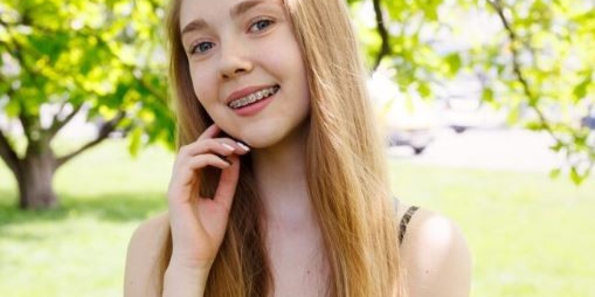 Braces for a Perfect Smile and Healthy Teeth: Complete Guide for Everyone