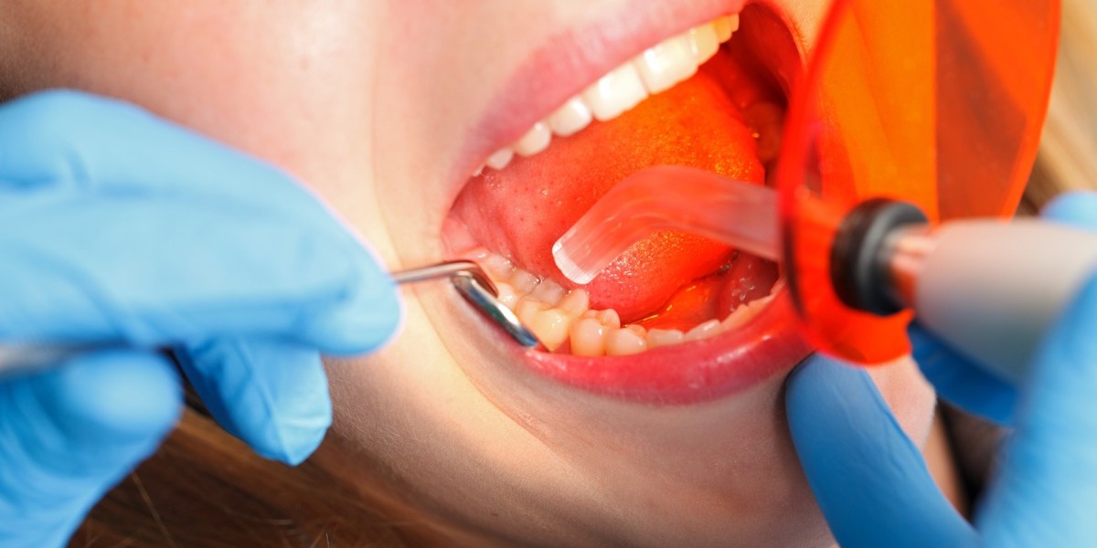 Everything You Need to Know About Modern Dental Tooth Fillings