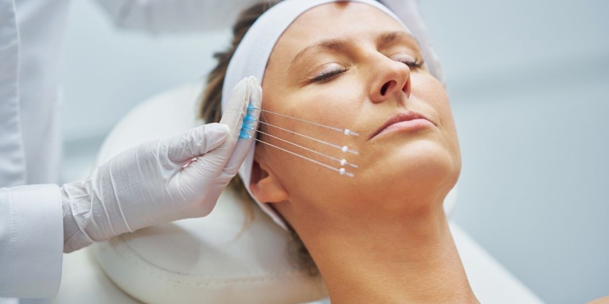 What are the Benefits of Sugar Thread Lift?