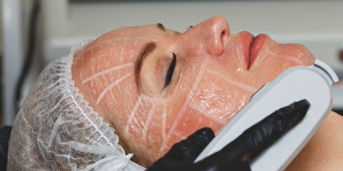 Does HIFU Treatment Really Work to Reduce Wrinkles?