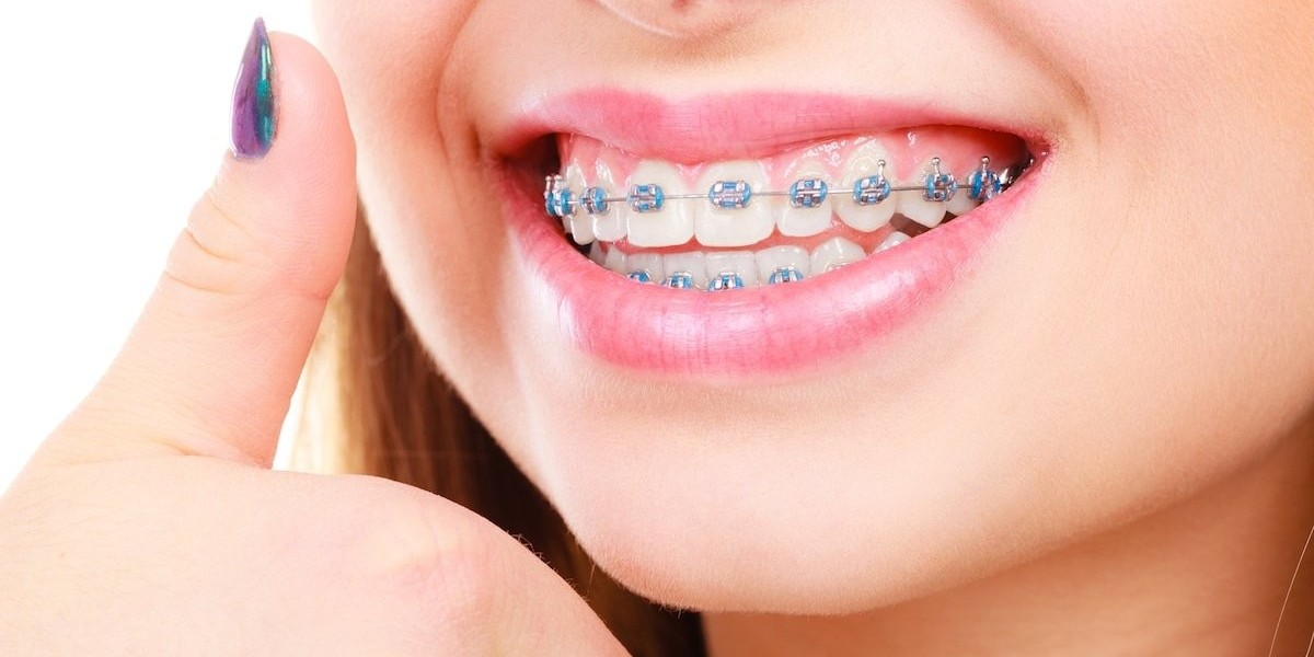 Emergency Braces Fixes in Dubai