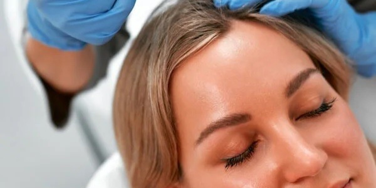 Before and After PRP Treatment: Realistic Results in Islamabad