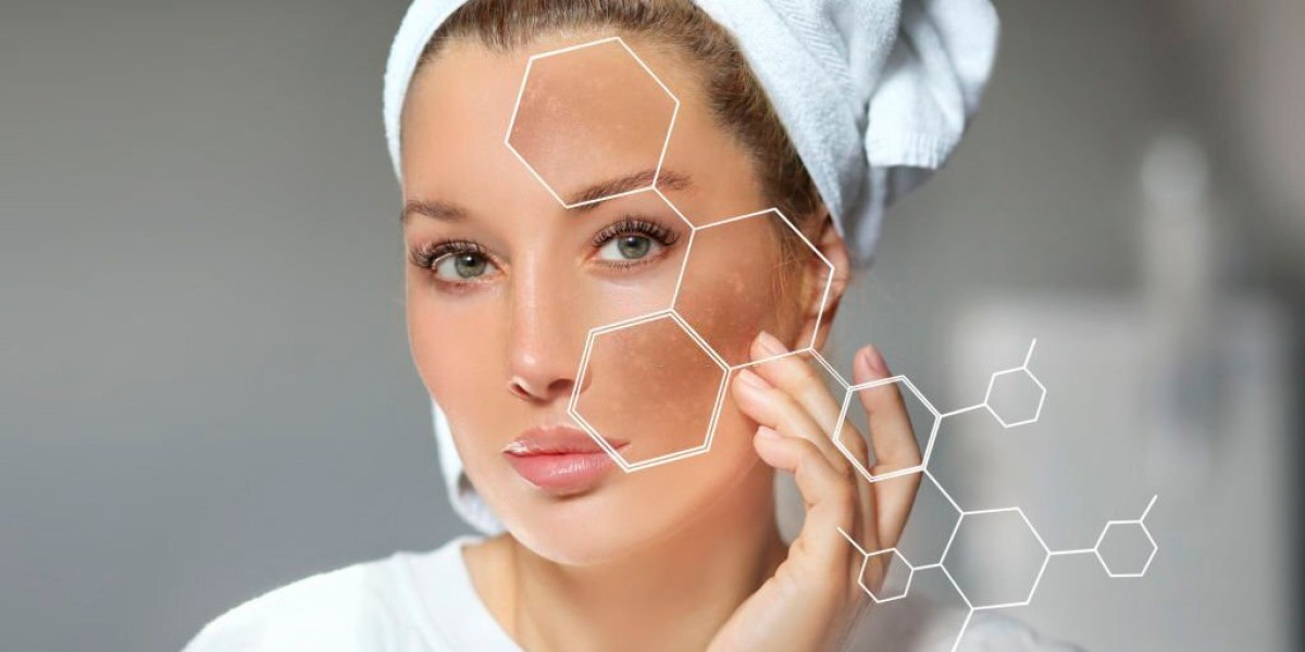 How Long Does Melasma Treatment Take to Work?